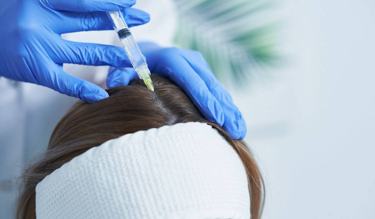 درمان های پزشکی جلوگیری از ریزش مو