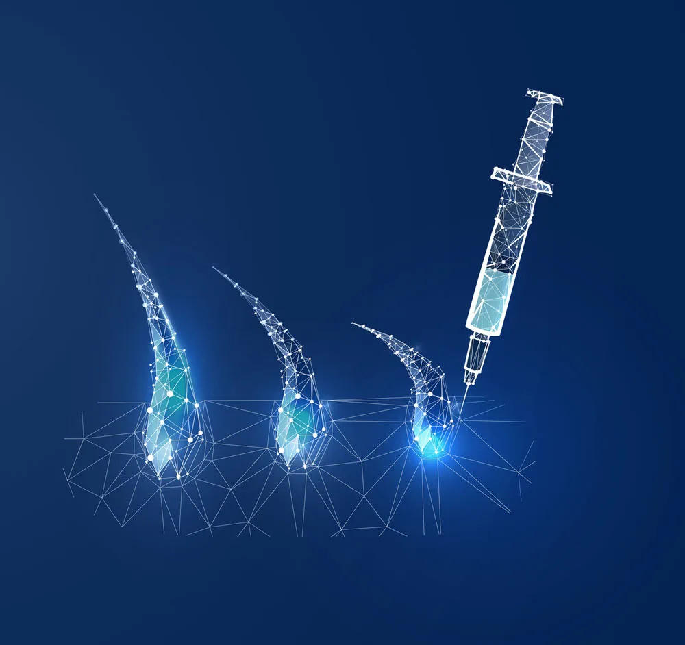 بهترین کلینیک های کاشت مو در کرج 5 روش مزوتراپی Mesotherapy