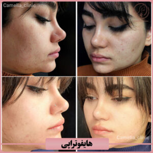 نمونه کار کلینیک زیبایی کاملیا