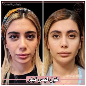 نمونه کار کلینیک زیبایی کاملیا