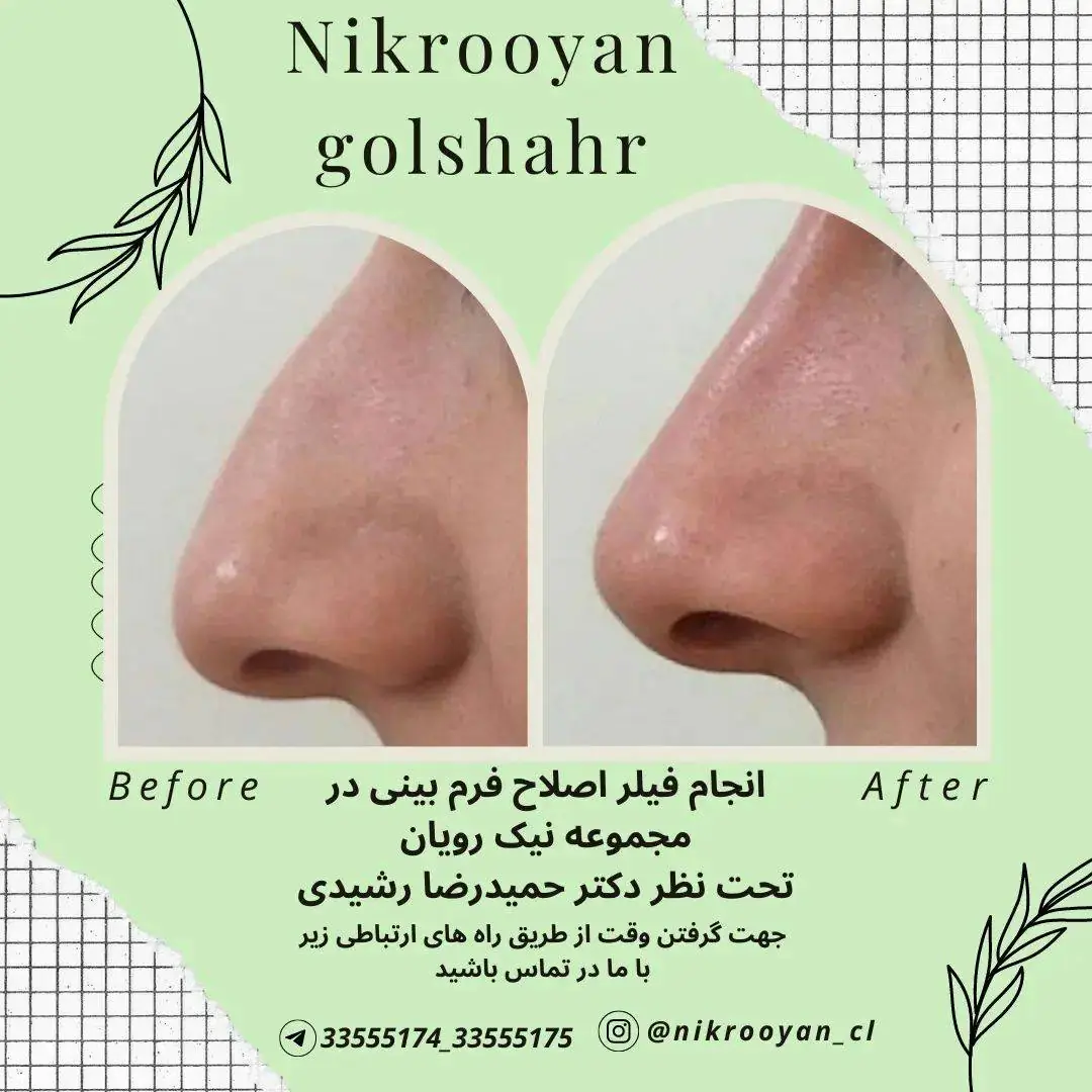 نمونه کارهای کلینیک نیک رویان