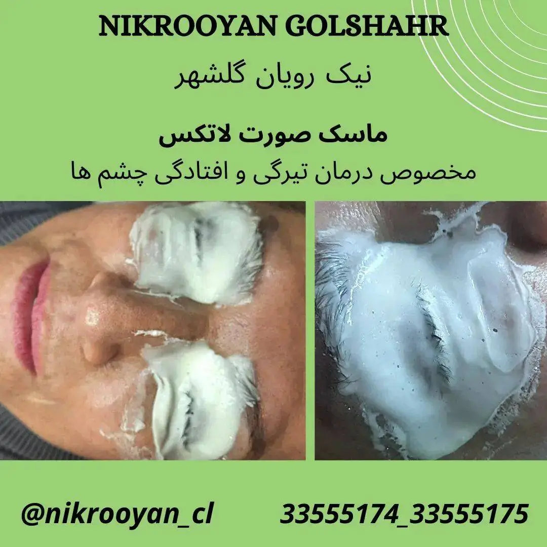 نمونه کارهای کلینیک نیک رویان