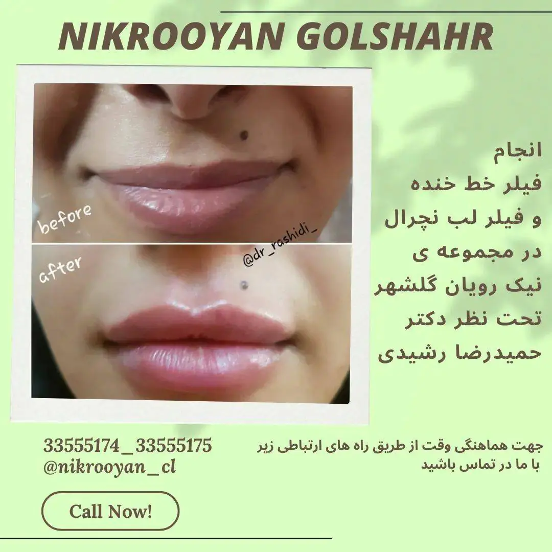 نمونه کارهای کلینیک نیک رویان