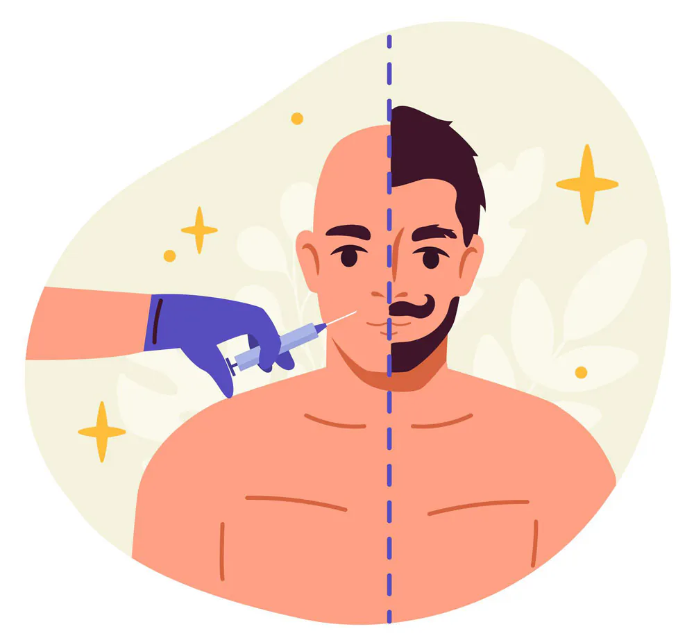 روش PRP (Platelet-Rich Plasma)