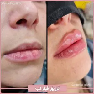 نمونه کار کلینیک زیبایی کاملیا