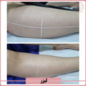 نمونه کار کلینیک زیبایی کاملیا