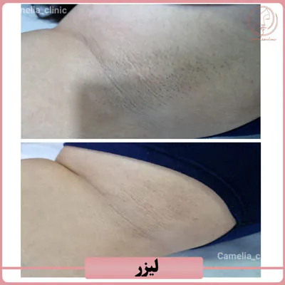 نمونه کارهای کلینیک زیبایی کاملیا